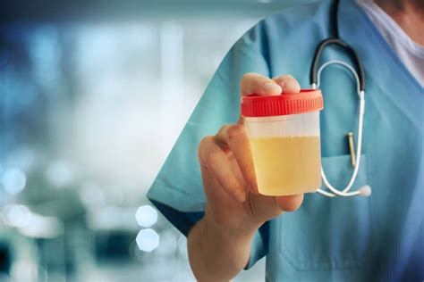 Urine Culture What Is It And Whats It Used For Step To Health