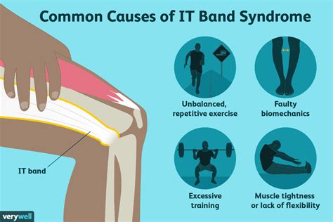 Iliotibial It Band Syndrome Causes Treatment And When To See A