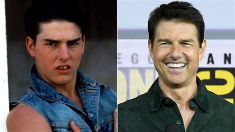 Tom Cruise Schiefe Zähne Promis Mit Neuen Zahnen Unser Grosser Vorher