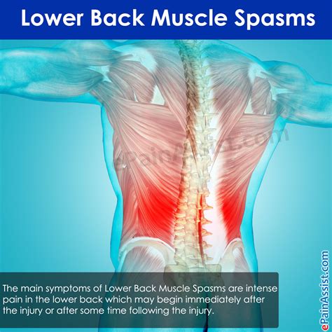 Lower Back Muscles Pain What Is A Good Treatment For Sore Lower Back