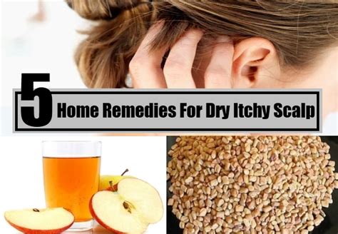 Dry Itchy Scalp Home Remedies Natural Treatments And Cure Herbal