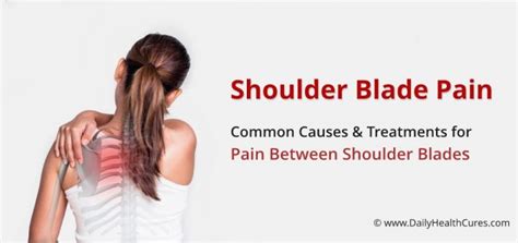 Shoulder Blade Pain 12 Possible Causes And Home Treatments
