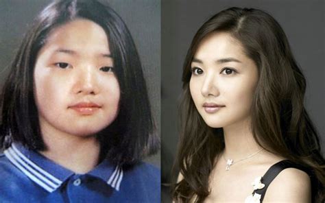 Park Min Young Before After