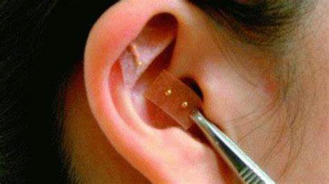 Серьга диета мухиной Серьга мухиной - 82 фото Серьга мухиной - 82 фото Серьга диета мухиной