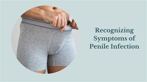 Balanitis Explained Everything You Need To Know About This Penis