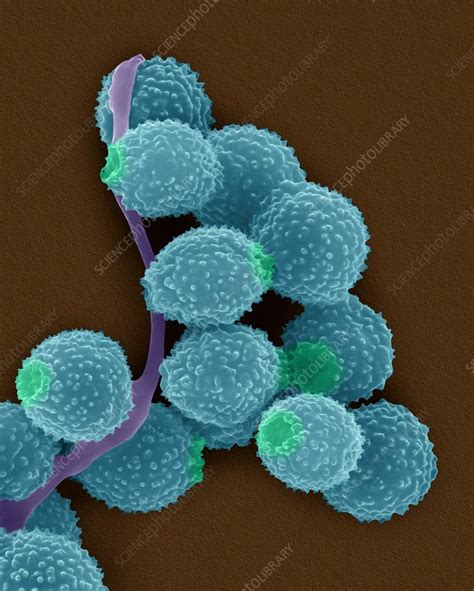 Powdery Mildew Mould Hypha And Spores Sem Stock Image C0323286