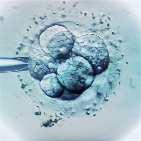 Post Embryo Transfer Dos And Donts