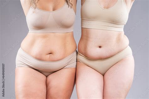 Tummy Tuck Two Fat Women With Flabby Bellies On Gray Background Plastic Surgery And Body