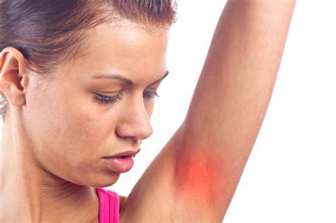 Itchy Armpits Itchy Underarms Common Causes And