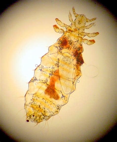Can Dog Lice Live On Humans And Other Lice Questions Answered