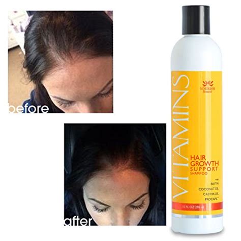According to the above study, if vitamin d is deficient, it can lead to reduced hair follicle growth. Vitamins Biotin Hair Growth Shampoo - 2021 Complete Review