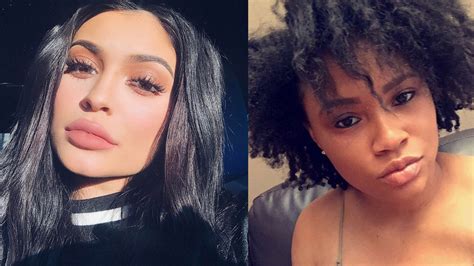 Having Big Lips Was A Choice For Kylie Jenner—but Not For Me Glamour