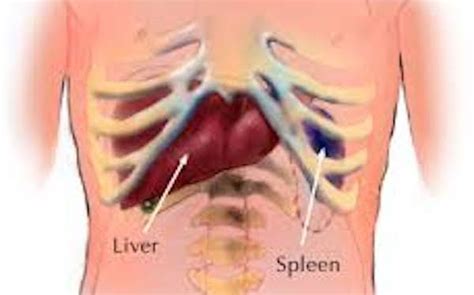 See full list on mayoclinic.org Enlarged Spleen (Splenomegaly) - Ayurvedic Diet & Natural ...