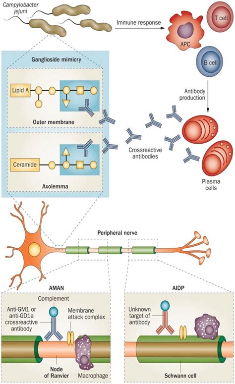 Acute Motor Axonal Neuropathy Hot Sex Picture