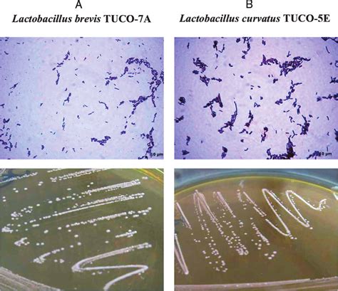 Lactobacillus Colony Morphology