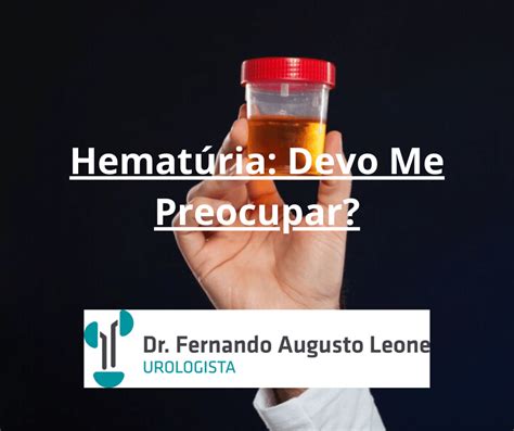 Hemat Ria Devo Me Preocupar Dr Fernando Leone Urologista Bh Uro Bh