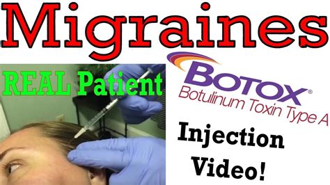 Botox For Chronic Headaches Or Migraines By John E Stavrakos Md With