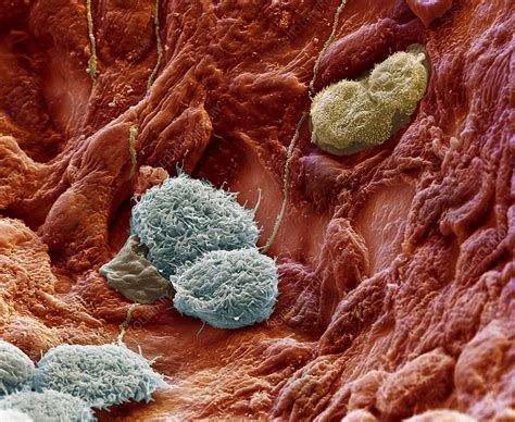 Alveolar macrophages, SEM - Stock Image C009/0408 - Science Photo Library