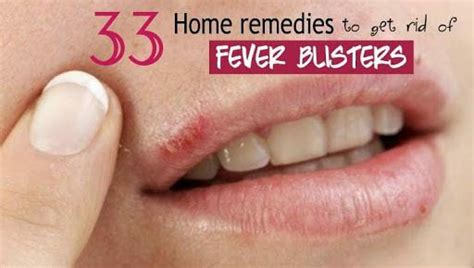Sign In Fever Blister How To Heal Blisters Sore Lips