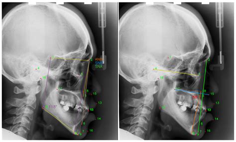 Applied Sciences | Free Full-Text | An Intelligent Shooting Reward