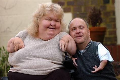 Thalidomide Survivors Darren Mansell And Louise Medus Bms Bachelor