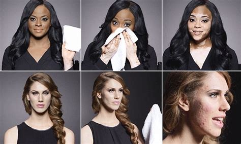 Women With Severe Skin Conditions Show How Cosmetics Can Be Empowering