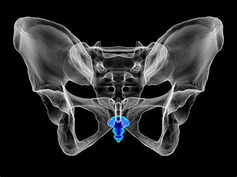 Unraveling The Mystery Of Tailbone Pain Common Causes And How To Find