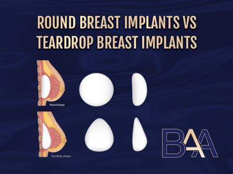 Round Breast Implants Vs Teardrop Breast Implants