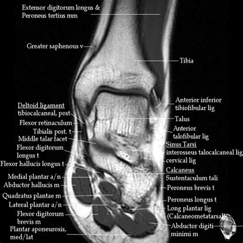 Ankle Xray Anatomy