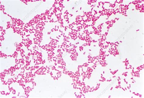 Lm Of The Gram Negative Bacteria E Coli Stock Image B2300001