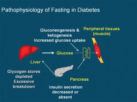 Pathophysiology Of Fasting In Diabetes Download Scientific Diagram