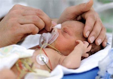 Tell Mothers About Skills To Care For A 6 Month Premature Baby