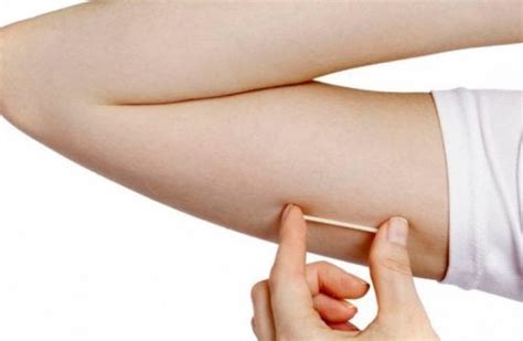 Subdermal Contraceptive Implants An Overview Step To Health