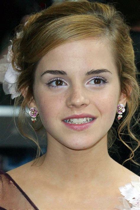Emma Watson Before And After Emma Watson Pics Emma Watson Beautiful Emma Watson