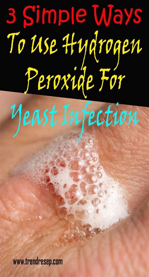 yeast infection cure yeast infection in men yeast