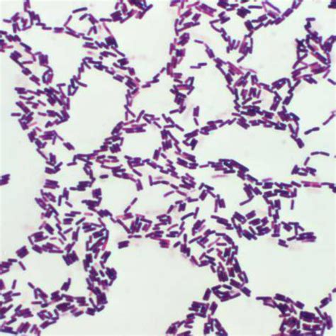 Bacillus Coagulans