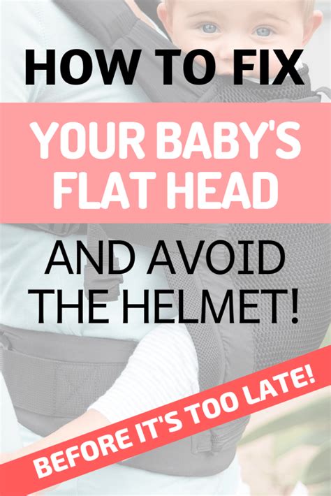 7 Unusual Tips To Prevent Flat Head Syndrome And A Baby Helmet