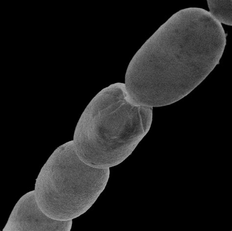 Giant New Bacteria Species Is So Big Its Visible To The Naked Eye