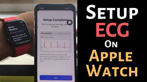 How To Setup Ecg On Apple Watch 876 In 2023 Hands On Export