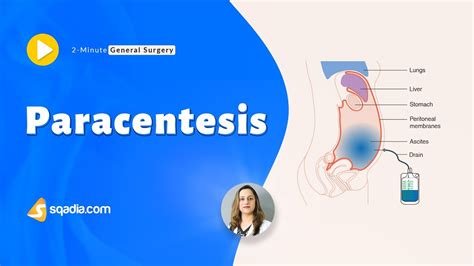 Paracentesis General Surgery Video Medical Education V Learning