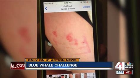 teen says she took part in blue whale challenge