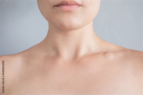 Foto Stock Swollen Supraclavicular Node Lump On The Clavicle Fluid