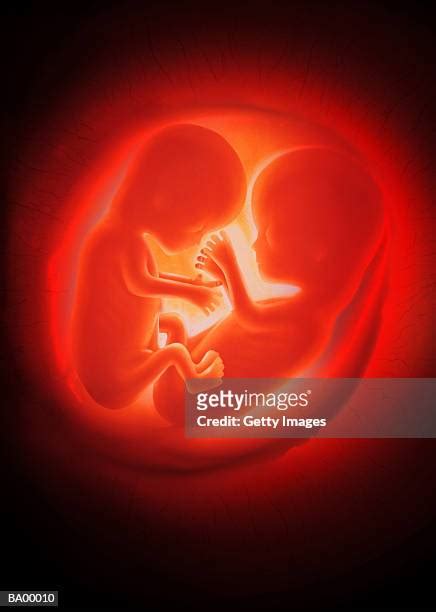 Twins In The Womb Photos And Premium High Res Pictures Getty Images