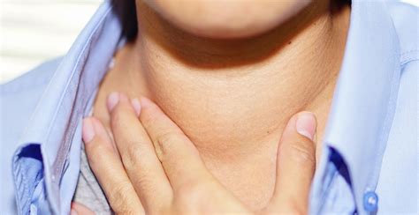 Goiter Overview Causes And Symptoms Rxsaver