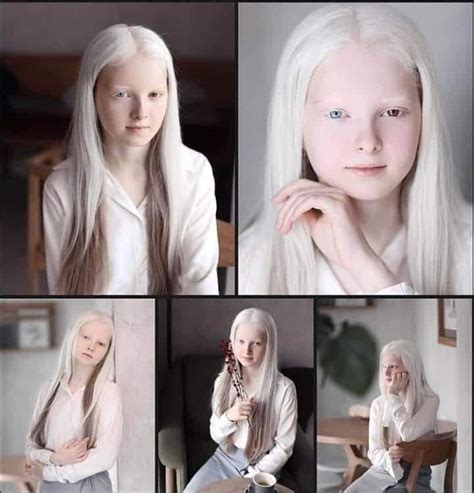 Ethereal Portraits Highlight The Unique Beauty Of A Girl With Albinism And Heterochromia Artofit