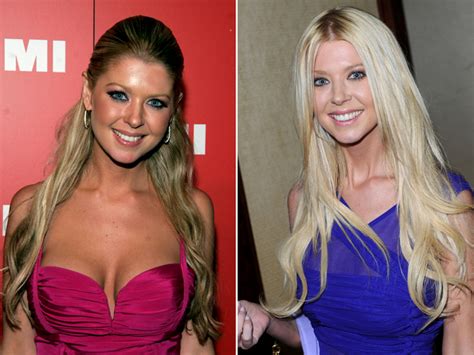 10 celebrities who had their breast implants removed
