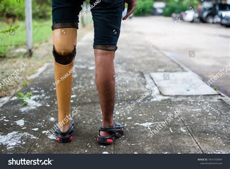 Disabled Man Prosthetic Legs Standing Stock Photo 1816103894 Shutterstock