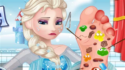 Frozen Princess Elsa - Elsa Foot Doctor Game - Baby Games ...