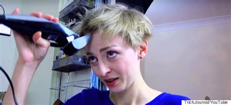 Woman With Hair Pulling Condition Trichotillomania Shaves Head In Brave