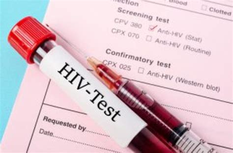 testare gratuită și anonimă pentru hiv și hepatita c la cluj napoca află unde și când